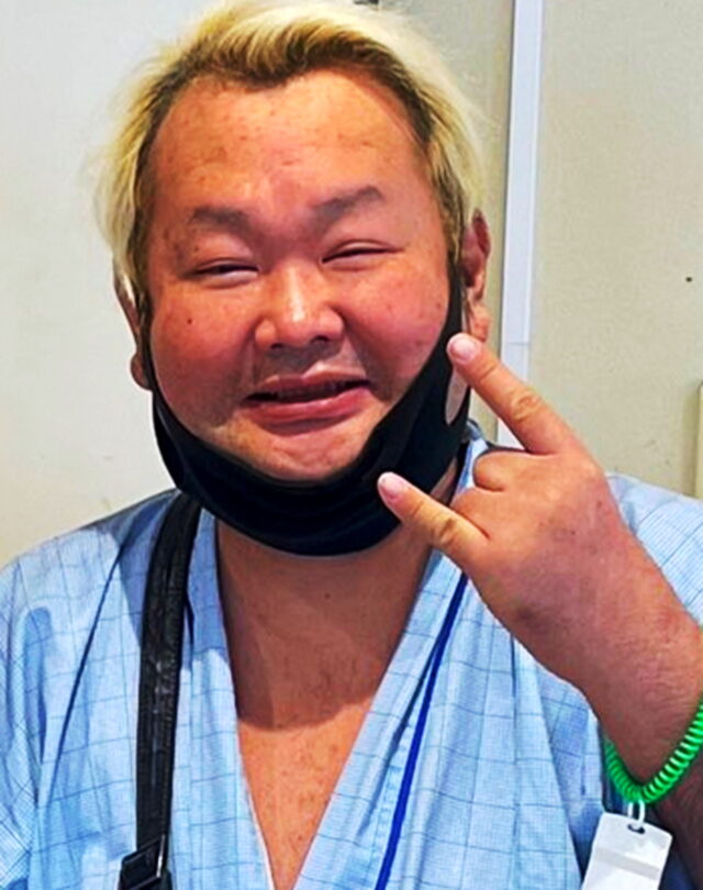 ハチミツ二郎が足を切断した理由はなぜ？noteの内容とは？病気について
